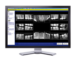 Dental X-ray Technology